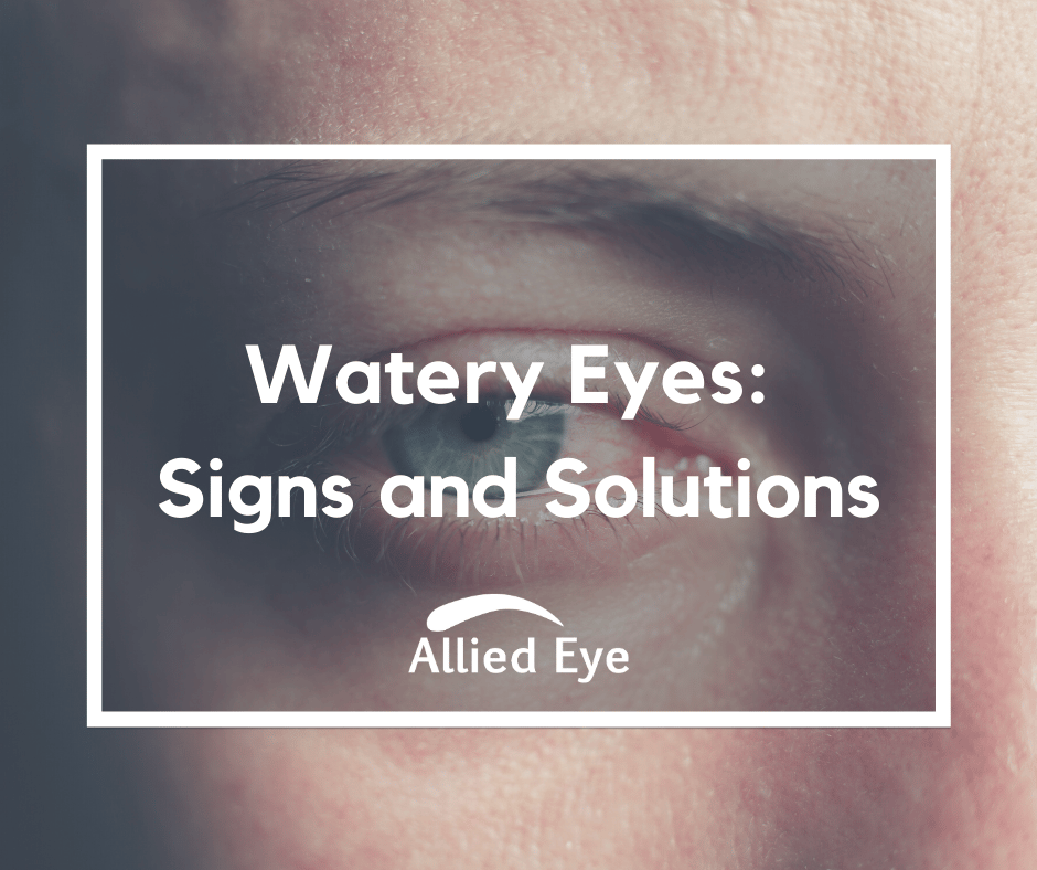 Watery Eyes Signs and Solutions